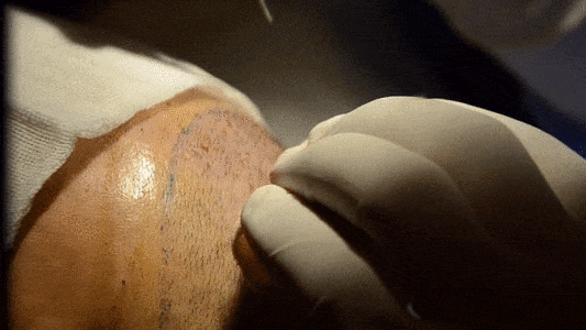 dhi sac ekimi hairneva kisa