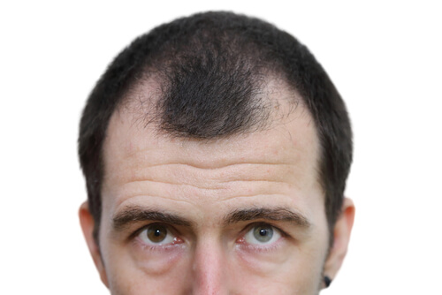 shutterstock_296948840