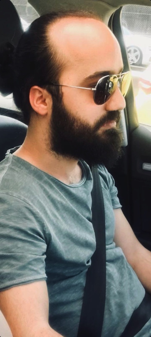 What are the best hair transplant centers in Turkey? - Hairneva What are the best hair transplant centers in Turkey? - Hairneva
