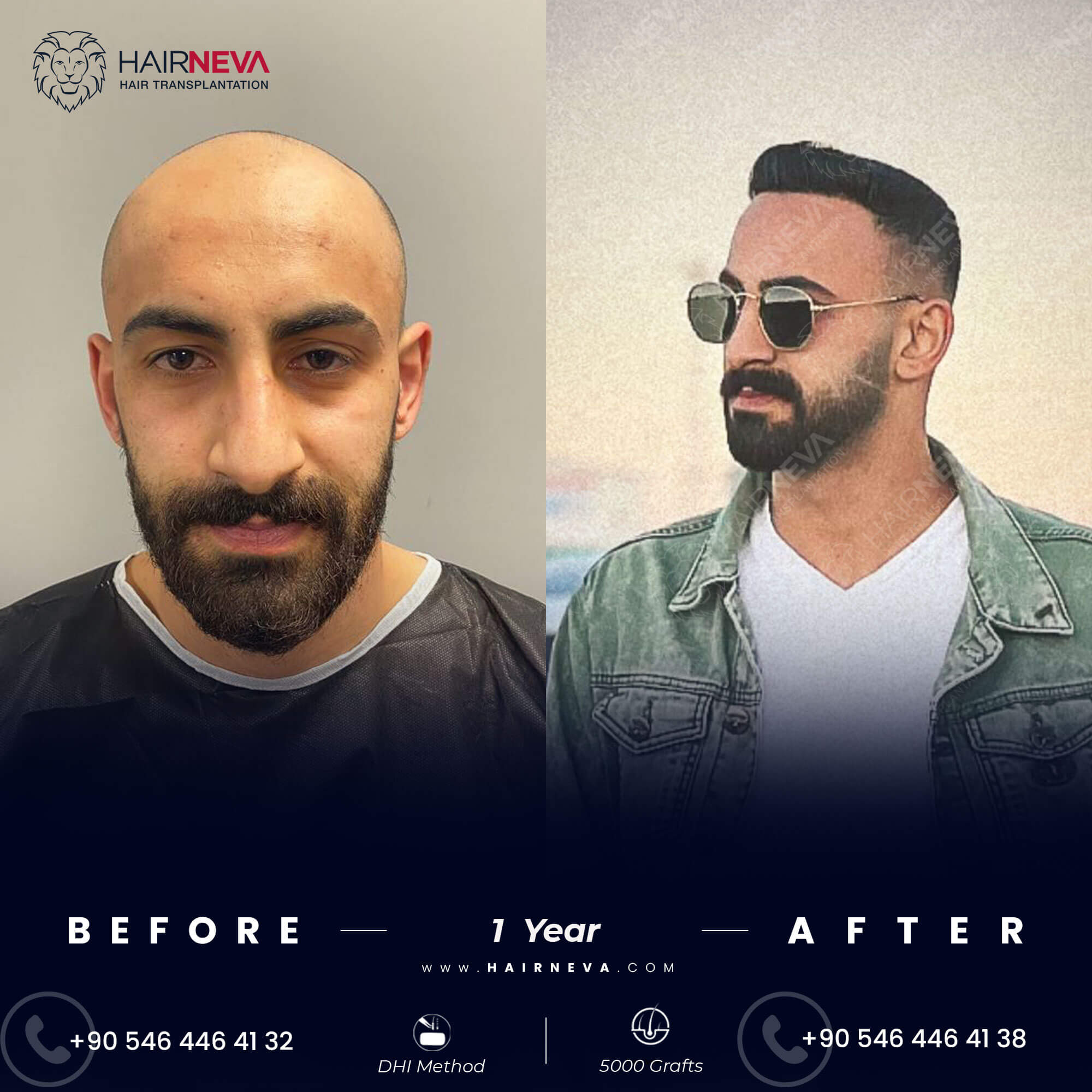 The Rad 140 Experiment: My Shocking Before & After Results