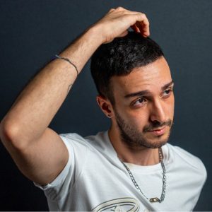 hair transplant
