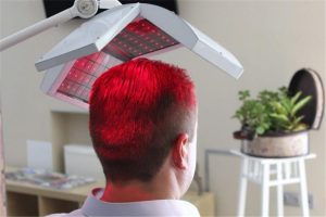 hair laser therapy