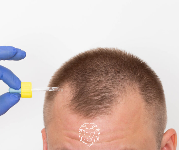 Minoxidil