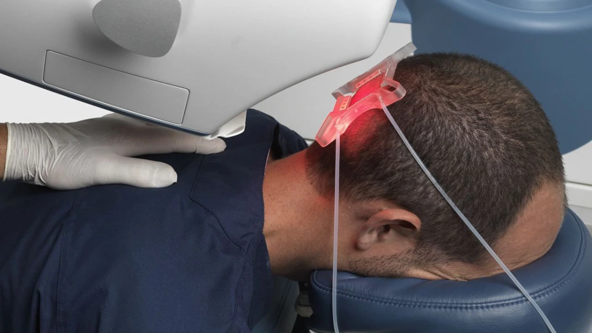 Terapia Láser Capilar