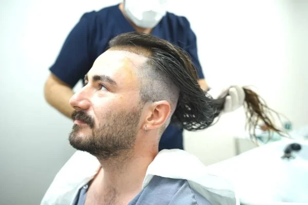 Langhaar-DHI-Haartransplantation