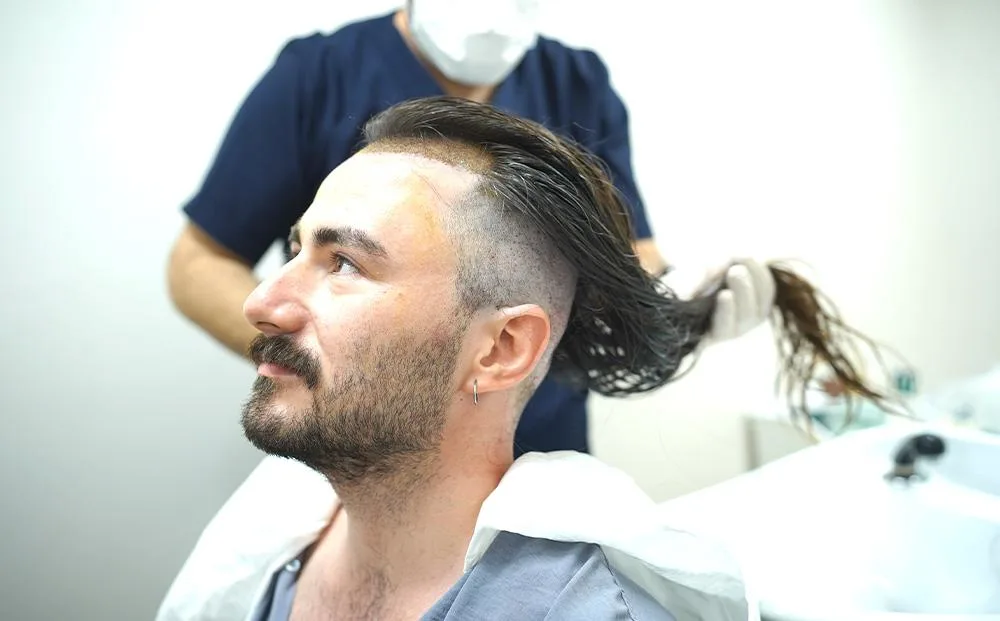 Worauf Sie bei der Wahl einer Haarklinik achten sollten?