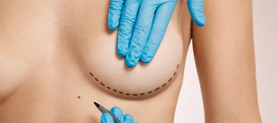 Breast Reduction 1 Breast Reduction