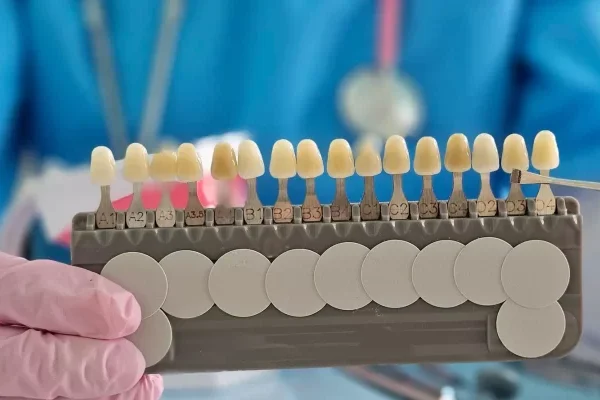 Dental Crowns and Bridges