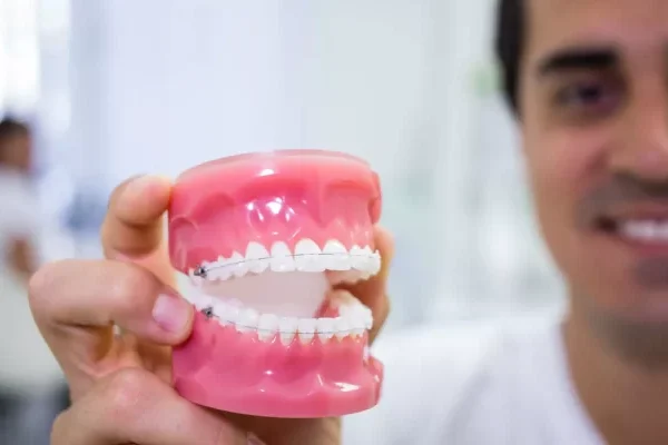 Full Mouth Dental Implants Turkey