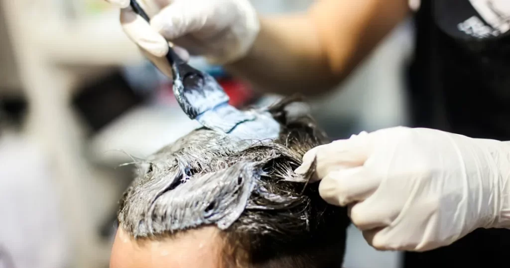 Saç Ekimi Sonrası Saç Boyası Ne Zaman Yapılır?