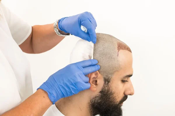 Kann ich nach der Haartransplantation in die Sauna oder ans Meer?