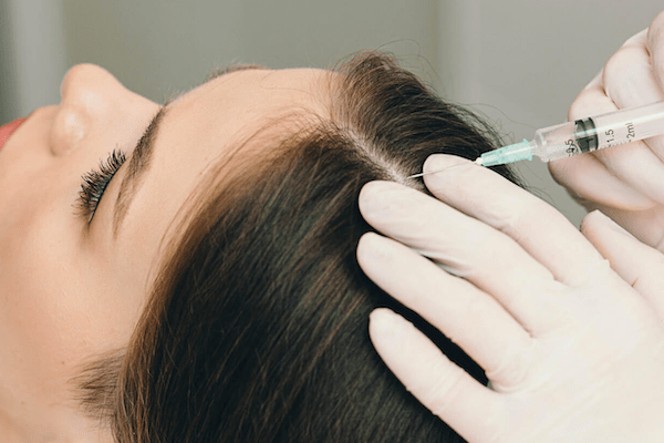 Trapianto di capelli con esosomi​