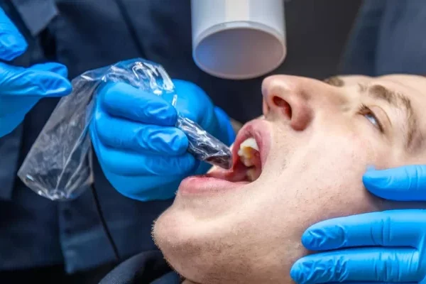 Canal Treatment Turkey