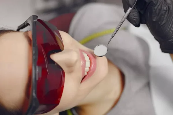 Dental Bonding Turkey