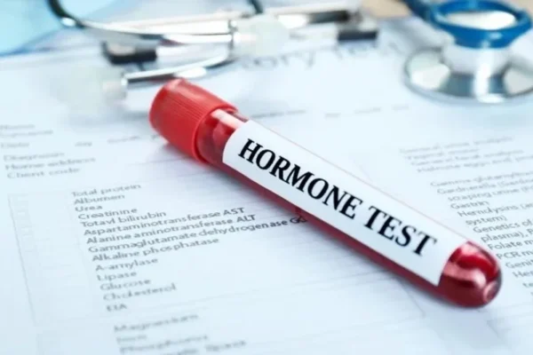 Saç Dökülmesi Hormon Testi