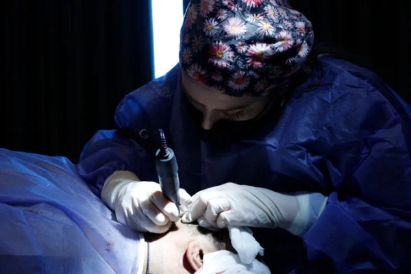 Saç Ekiminden Sonra Bere Takmak