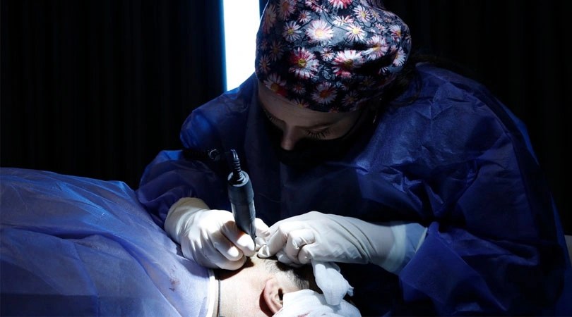 Saç Ekiminden Sonra Bere Takmak