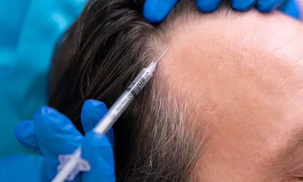 ما هي طرق تدمير خصلات الشعر البيضاء؟