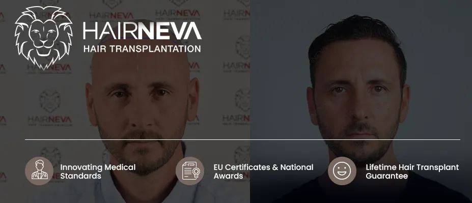 hair transplant in turkey cost