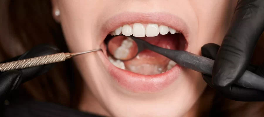 broken-tooth-treatment