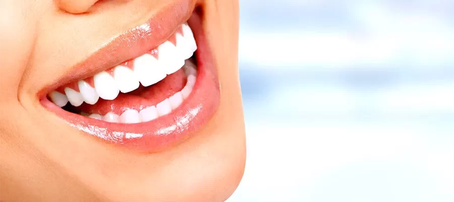 smile-design