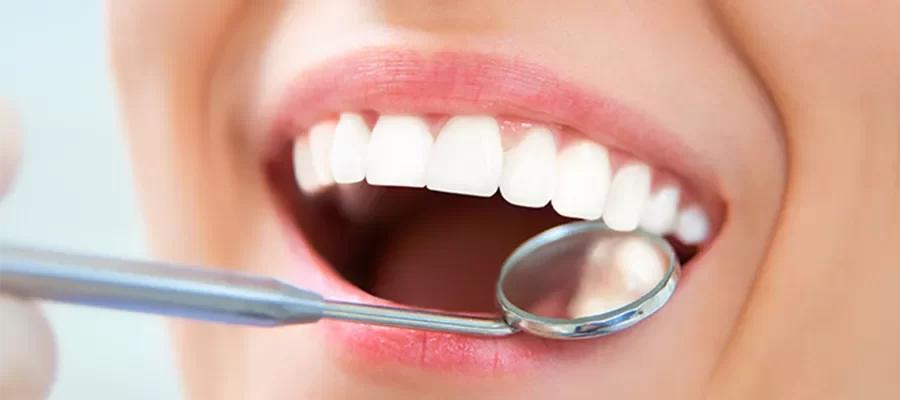 teeth-whitening